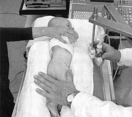 Badanie bioderek u niemowląt metodą prof. Reinharda Grafa